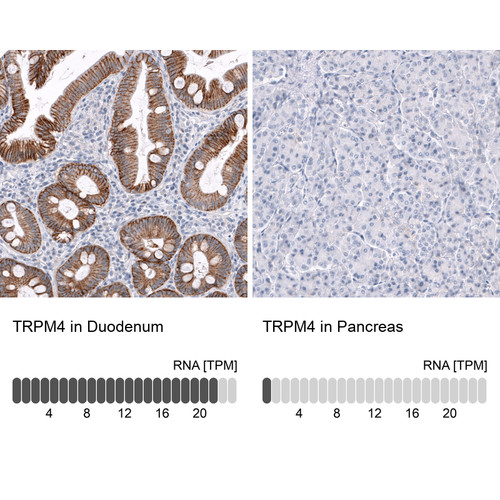 Immunohistochemistry analysis in human duodenum and pancreas tissues using AMAb91693 antibody. Corresponding TRPM4 RNA-seq data are presented for the same tissues.