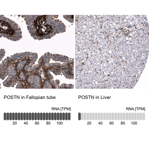 Immunohistochemistry analysis in human fallopian tube and liver tissues using AMAb91764 antibody. Corresponding POSTN RNA-seq data are presented for the same tissues.