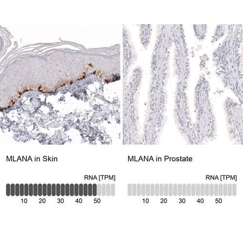 Immunohistochemistry analysis in human skin and prostate tissues using AMAb91817 antibody. Corresponding MLANA RNA-seq data are presented for the same tissues.