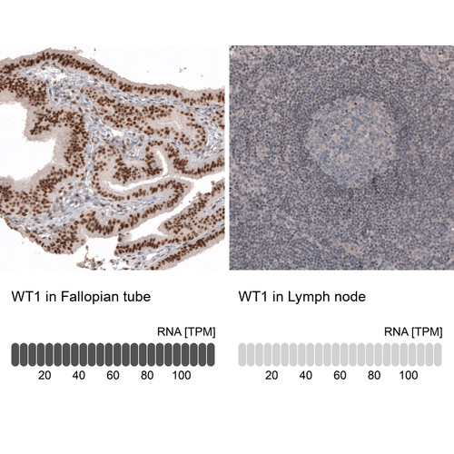 Immunohistochemistry analysis in human fallopian tube and lymph node tissues using AMAb91839 antibody. Corresponding WT1 RNA-seq data are presented for the same tissues.