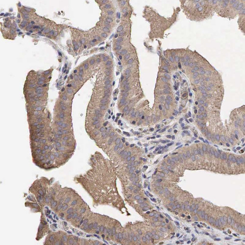 Immunohistochemical staining of human gall bladder shows moderate cytoplasmic positivity in glandular cells.