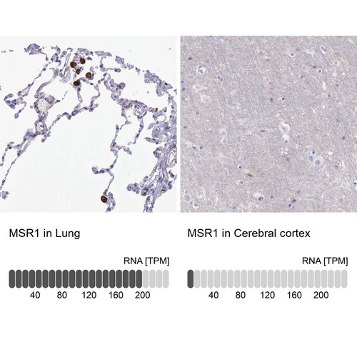 Immunohistochemistry analysis in human lung and cerebral cortex tissues using HPA000272 antibody. Corresponding MSR1 RNA-seq data are presented for the same tissues.