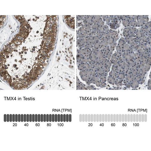 Immunohistochemistry analysis in human testis and pancreas tissues using Anti-TMX4 antibody. Corresponding TMX4 RNA-seq data are presented for the same tissues.