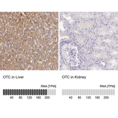Immunohistochemistry analysis in human liver and kidney tissues using HPA000570 antibody. Corresponding OTC RNA-seq data are presented for the same tissues.