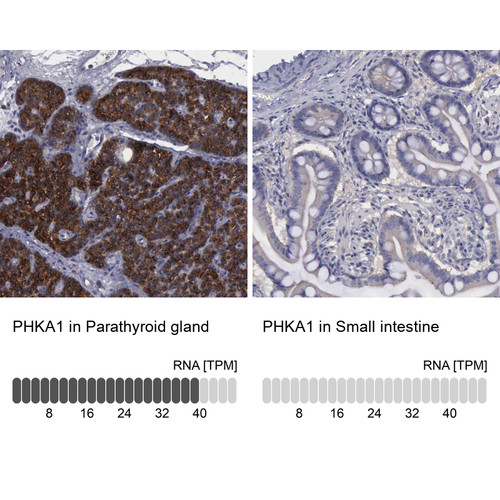 Immunohistochemistry analysis in human parathyroid gland and small intestine tissues using Anti-PHKA1 antibody. Corresponding PHKA1 RNA-seq data are presented for the same tissues.