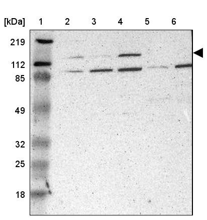 Lane 1: Marker [kDa] 219, 112, 85, 49, 32, 25, 18<br/>Lane 2: Human cell line RT-4<br/>Lane 3: Human cell line U-251MG sp<br/>Lane 4: Human cell line A-431<br/>Lane 5: Human liver tissue<br/>Lane 6: Human tonsil tissue