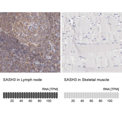Immunohistochemistry analysis in human lymph node and skeletal muscle tissues using HPA001085 antibody. Corresponding SASH3 RNA-seq data are presented for the same tissues.