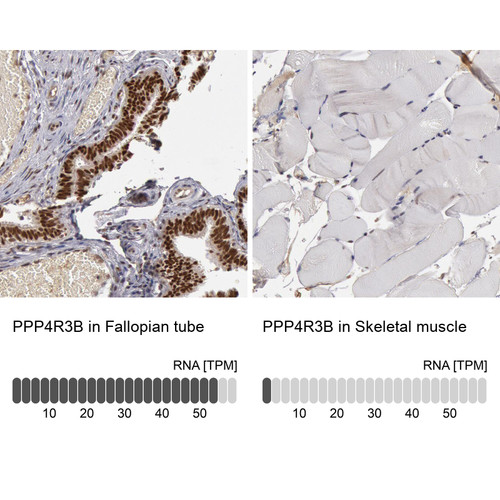 Immunohistochemistry analysis in human fallopian tube and skeletal muscle tissues using HPA001233 antibody. Corresponding PPP4R3B RNA-seq data are presented for the same tissues.