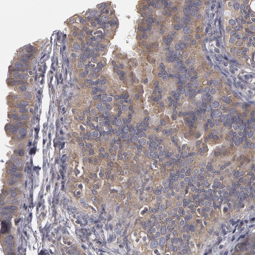 Immunohistochemical staining of human fallopian tube shows weak to moderate cytoplasmic positivity in glandular cells.
