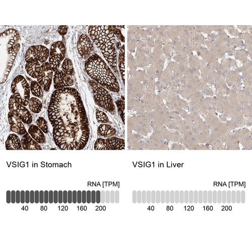 Immunohistochemistry analysis in human stomach and liver tissues using Anti-VSIG1 antibody. Corresponding VSIG1 RNA-seq data are presented for the same tissues. Immunohistochemistry analysis in human stomach and liver tissues using Anti-VSIG1 antibody. Corresponding VSIG1 RNA-seq data are presented for the same tissues.