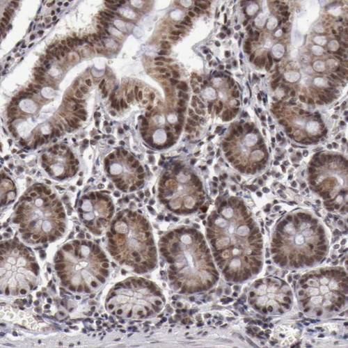 Immunohistochemical staining of human small intestine shows nuclear and cytoplasmic positivity in glandular cells.