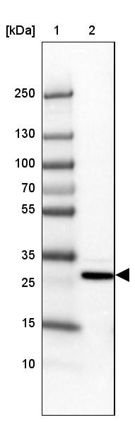 Lane 1: Marker [kDa] 250, 130, 100, 70, 55, 35, 25, 15, 10<br/>Lane 2: Human cell line HepG2