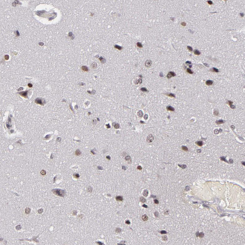 Immunohistochemical staining of human caudate shows nucleolar positivity in neuronal cells and nuclear positivity in glial cells.