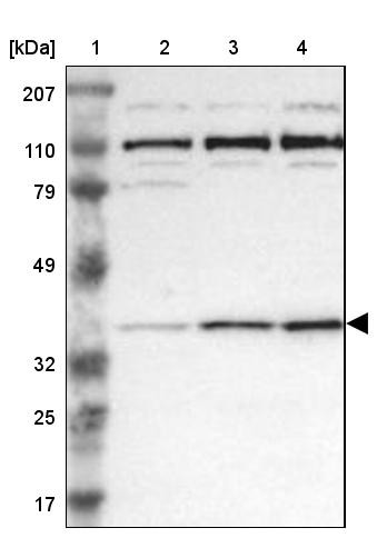 Lane 1: Marker [kDa] 207, 110, 79, 49, 32, 25, 17<br/>Lane 2: Human cell line RT-4<br/>Lane 3: Human cell line EFO-21<br/>Lane 4: Human cell line A-431