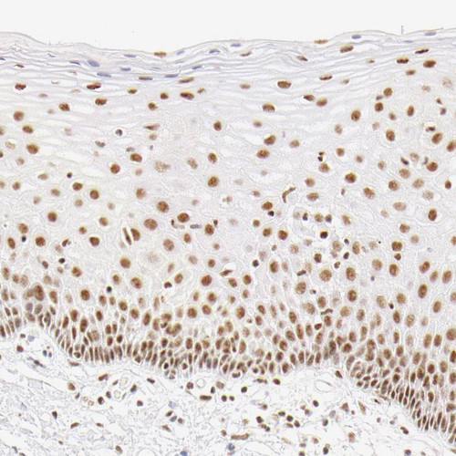 Immunohistochemical staining of human cervix, uterine shows moderate nuclear positivity in keratinocytes. Immunohistochemical staining of human cervix, uterine shows moderate nuclear positivity in keratinocytes.