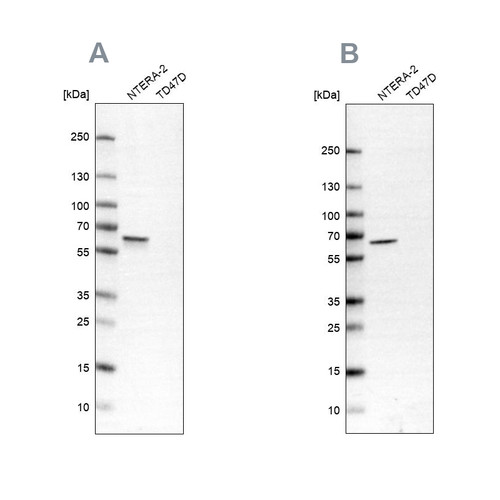 Western blot analysis using Anti-UPF3B antibody HPA001592 (A) shows similar pattern to independent antibody HPA001882 (B).