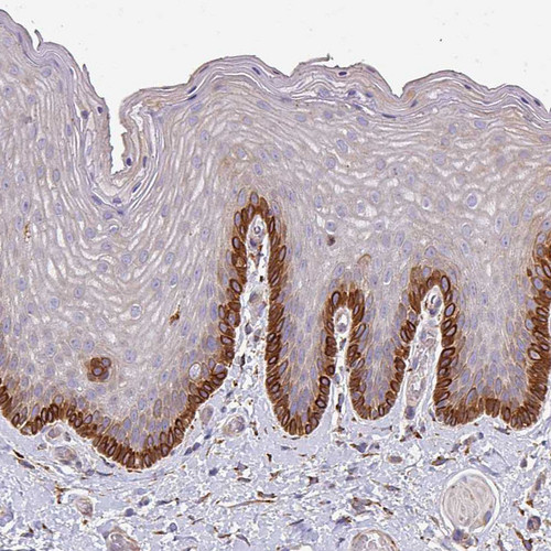Immunohistochemical staining of human skin shows strong cytoplasmic positivity in basal epidermal cells.