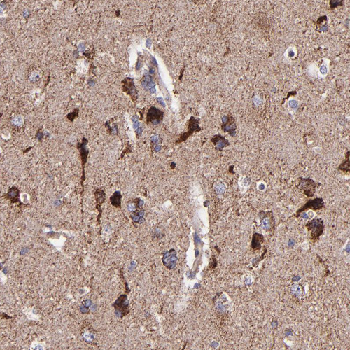 Immunohistochemical staining of human cerebral cortex shows strong cytoplasmic positivity in neurons.