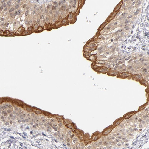 Immunohistochemical staining of human urinary bladder shows strong cytoplasmic positivity in urothelial cells.