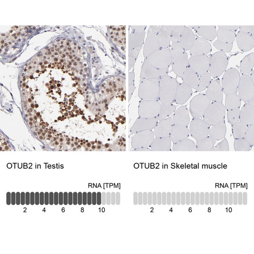 Immunohistochemistry analysis in human testis and skeletal muscle tissues using Anti-OTUB2 antibody. Corresponding OTUB2 RNA-seq data are presented for the same tissues.