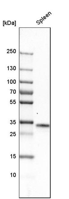 Western blot analysis in human spleen tissue.