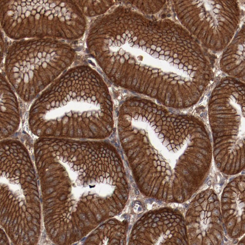 Immunohistochemical staining of human stomach shows strong cytoplasmic and membranous positivity in glandular cells.