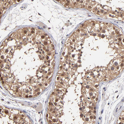Immunohistochemical staining of human testis shows moderate nuclear and cytoplasmic positivity in cells in seminiferous ducts.