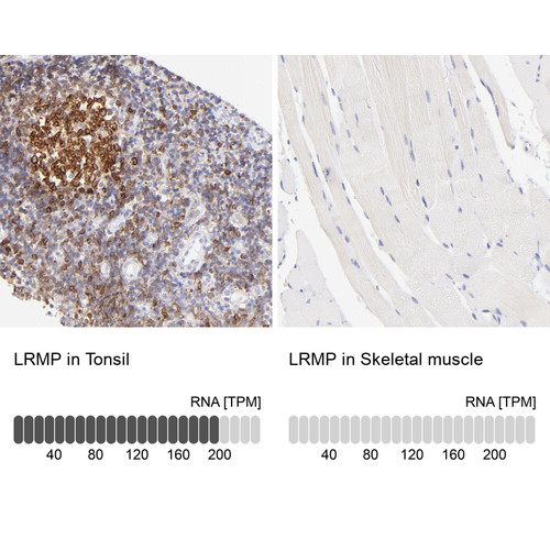 Immunohistochemistry analysis in human tonsil and skeletal muscle tissues using HPA002967 antibody. Corresponding LRMP RNA-seq data are presented for the same tissues.