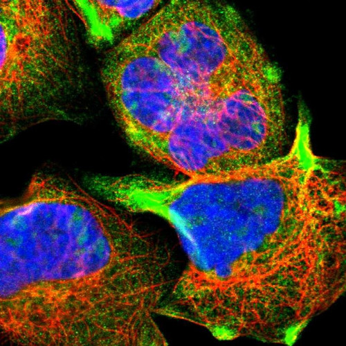 Immunofluorescent staining of human cell line A-431 shows positivity in nucleoli & cytoplasm.