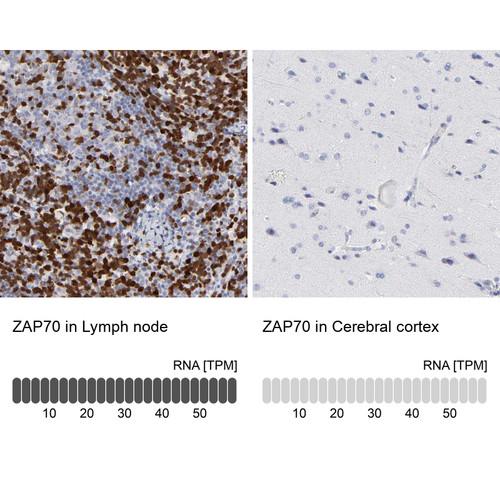 Immunohistochemistry analysis in human lymph node and cerebral cortex tissues using Anti-ZAP70 antibody. Corresponding ZAP70 RNA-seq data are presented for the same tissues.
