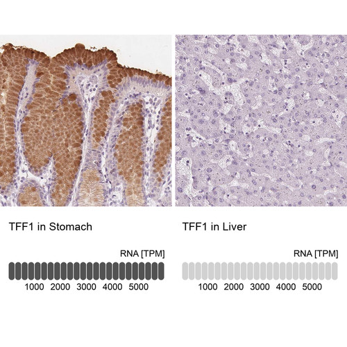 Immunohistochemistry analysis in human stomach and liver tissues using Anti-TFF1 antibody. Corresponding TFF1 RNA-seq data are presented for the same tissues.