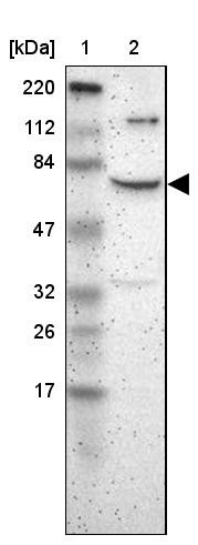 Lane 1: Marker [kDa] 220, 112, 84, 47, 32, 26, 17<br/>Lane 2: Human cell line RT-4