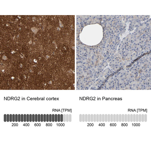 Immunohistochemistry analysis in human cerebral cortex and pancreas tissues using Anti-NDRG2 antibody. Corresponding NDRG2 RNA-seq data are presented for the same tissues.