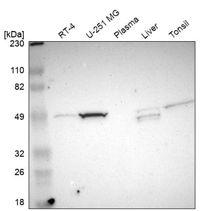 Western blot analysis in human cell line RT-4, human cell line U-251 MG, human plasma, human liver tissue and human tonsil tissue.