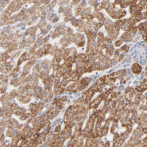 Immunohistochemical staining of human liver shows strong cytoplasmic positivity in hepatocytes.