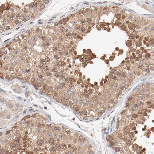 Immunohistochemical staining of human testis shows moderate cytoplasmic positivity in cells in seminiferous ducts.