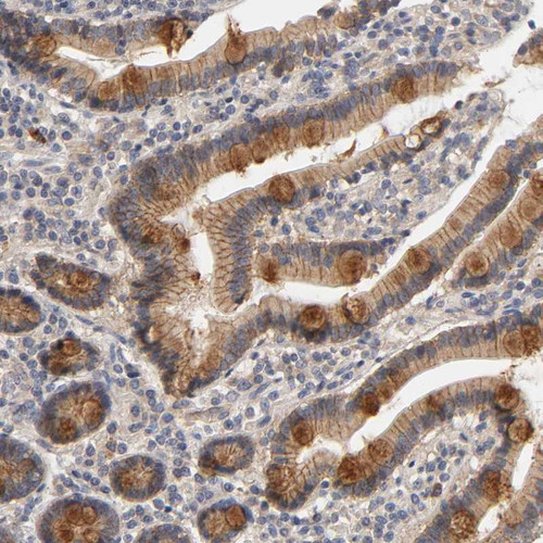 Immunohistochemical staining of human duodenum shows cytoplasmic positivity in glandular cells.