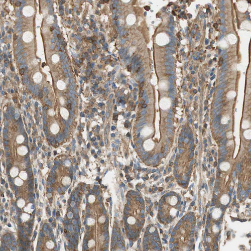 Immunohistochemical staining of human duodenum shows moderate to strong membranous positivity in glandular cells.