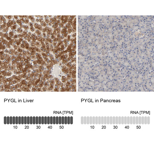 Immunohistochemistry analysis in human liver and pancreas tissues using HPA004119 antibody. Corresponding PYGL RNA-seq data are presented for the same tissues.