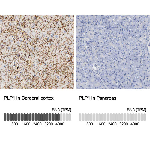 Immunohistochemistry analysis in human cerebral cortex and pancreas tissues using Anti-PLP1 antibody. Corresponding PLP1 RNA-seq data are presented for the same tissues.