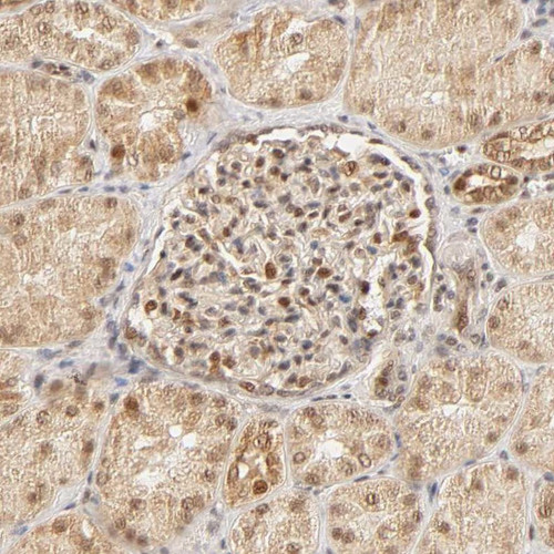 Immunohistochemical staining of human kidney shows nuclear positivity in cells in tubules nad cells in glomeruli. Immunohistochemical staining of human kidney shows nuclear positivity in cells in tubules nad cells in glomeruli.