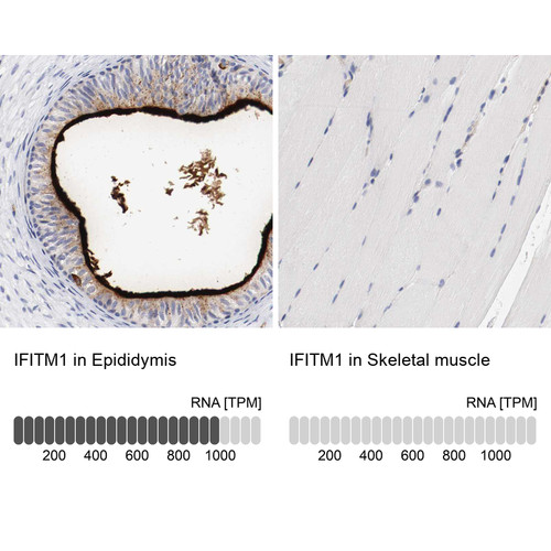 Immunohistochemistry analysis in human epididymis and skeletal muscle tissues using HPA004810 antibody. Corresponding IFITM1 RNA-seq data are presented for the same tissues.