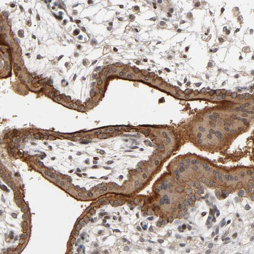 Immunohistochemical staining of human placenta shows strong cytoplasmic and membranous positivity in trophoblastic cells.