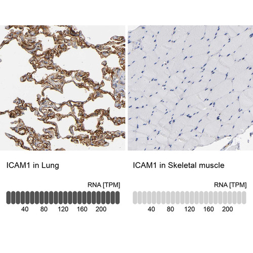 Immunohistochemistry analysis in human lung and skeletal muscle tissues using HPA004877 antibody. Corresponding ICAM1 RNA-seq data are presented for the same tissues.