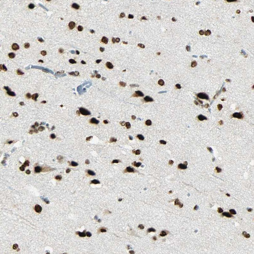 Immunohistochemical staining of human cerebral cortex shows strong nuclear positivity in neuronal cells and glial cells. Immunohistochemical staining of human cerebral cortex shows strong nuclear positivity in neuronal cells and glial cells.