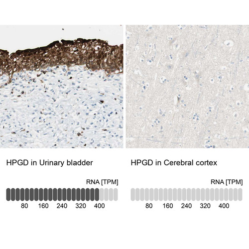 Immunohistochemistry analysis in human urinary bladder and cerebral cortex tissues using HPA004919 antibody. Corresponding HPGD RNA-seq data are presented for the same tissues.