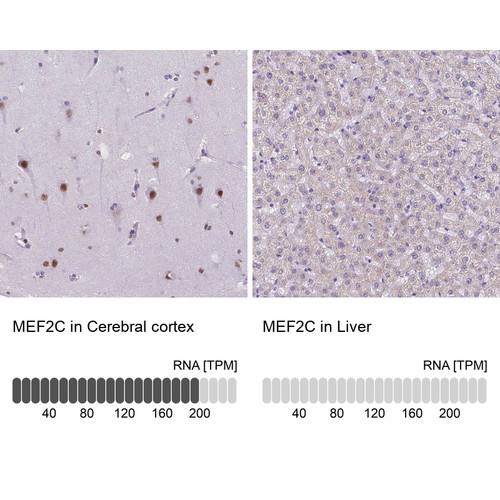 Immunohistochemistry analysis in human cerebral cortex and liver tissues using HPA005533 antibody. Corresponding MEF2C RNA-seq data are presented for the same tissues. Immunohistochemistry analysis in human cerebral cortex and liver tissues using HPA005533 antibody. Corresponding MEF2C RNA-seq data are presented for the same tissues.