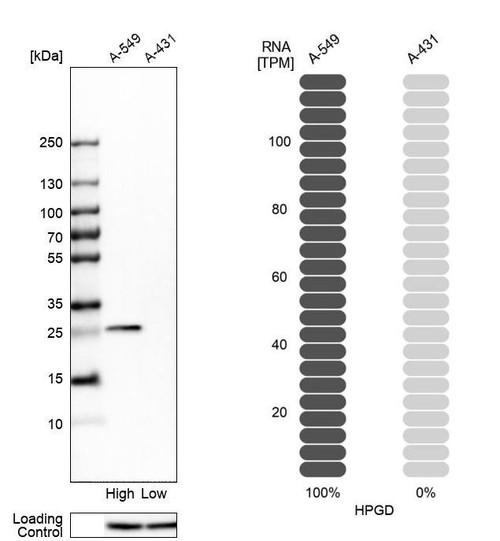 Western blot analysis in human cell lines A-549 and A-431 using Anti-HPGD antibody. Corresponding HPGD RNA-seq data are presented for the same cell lines. Loading control: Anti-PPIB.