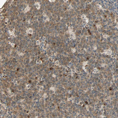 Immunohistochemical staining of human lymph node shows cytoplasmic positivity in reaction center cells.