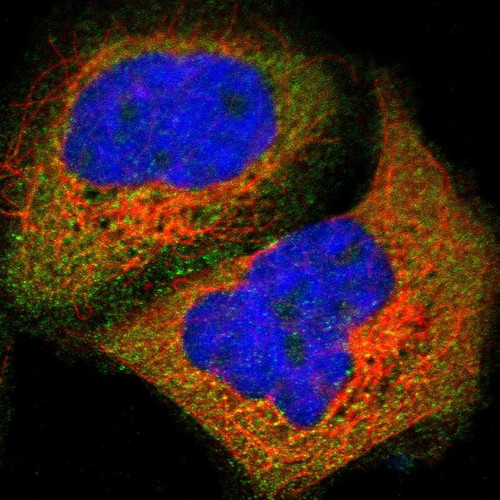 Immunofluorescent staining of human cell line A-431 shows localization to cytosol.